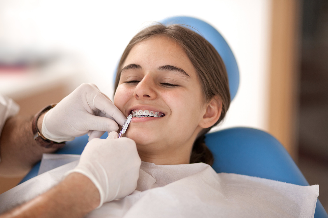 Dental braces